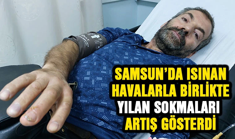 Samsun'da ısınan havalarla birlikte yılan sokmaları arttı