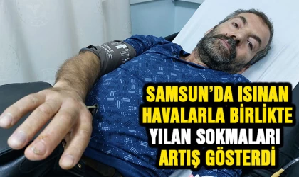 Samsun'da ısınan havalarla birlikte yılan sokmaları arttı